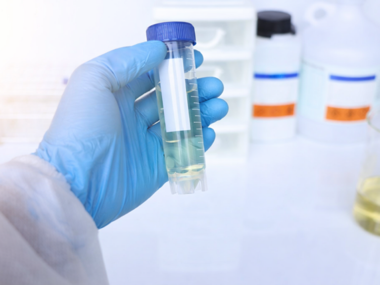 Amostra de urina em tubo cônico sendo preparada em laboratório para análise toxicológica por imunoensaios e espectrometria de massas.